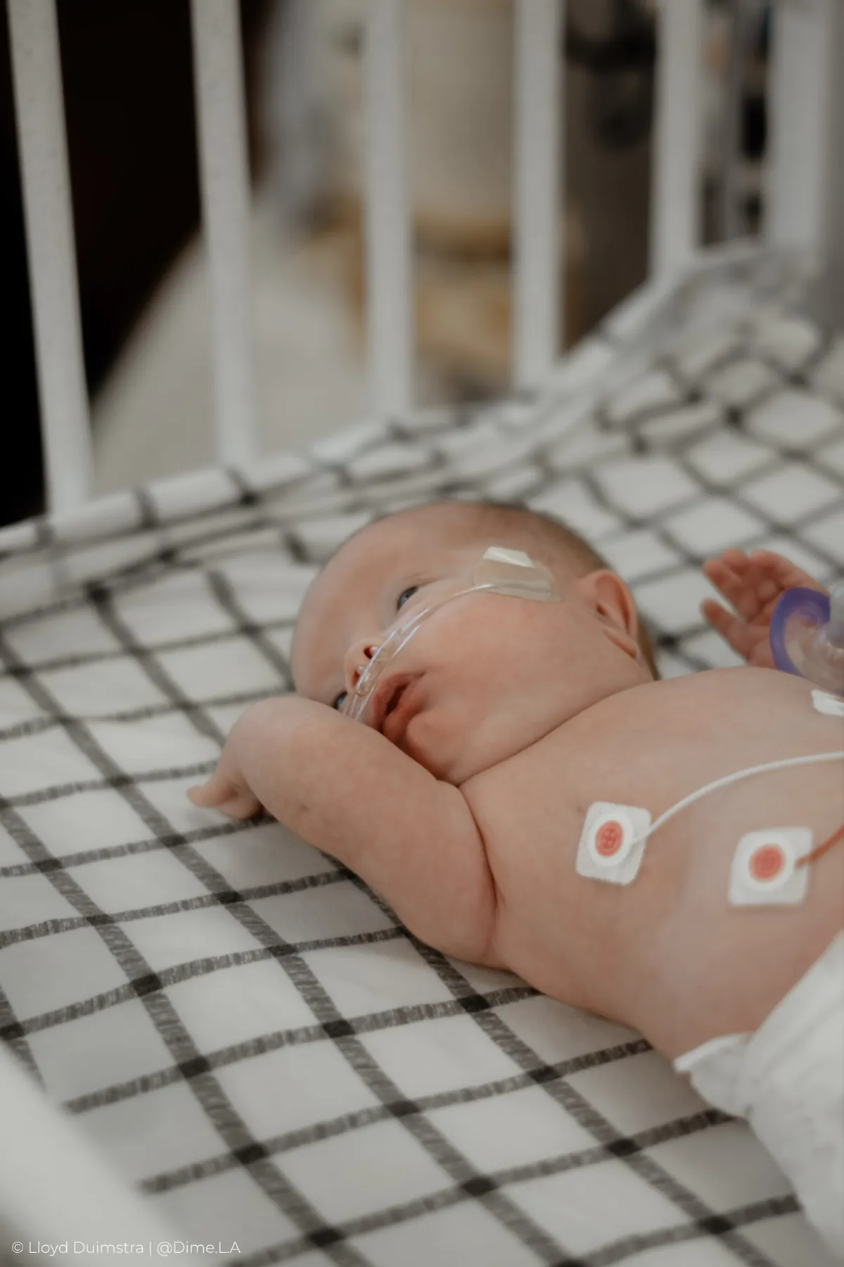 Tiny NICU newborn with his monitor leads, documentary session