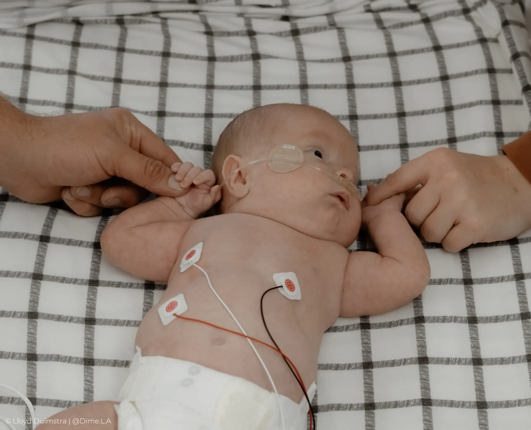 Parents' hands comforting their newborn in the NICU