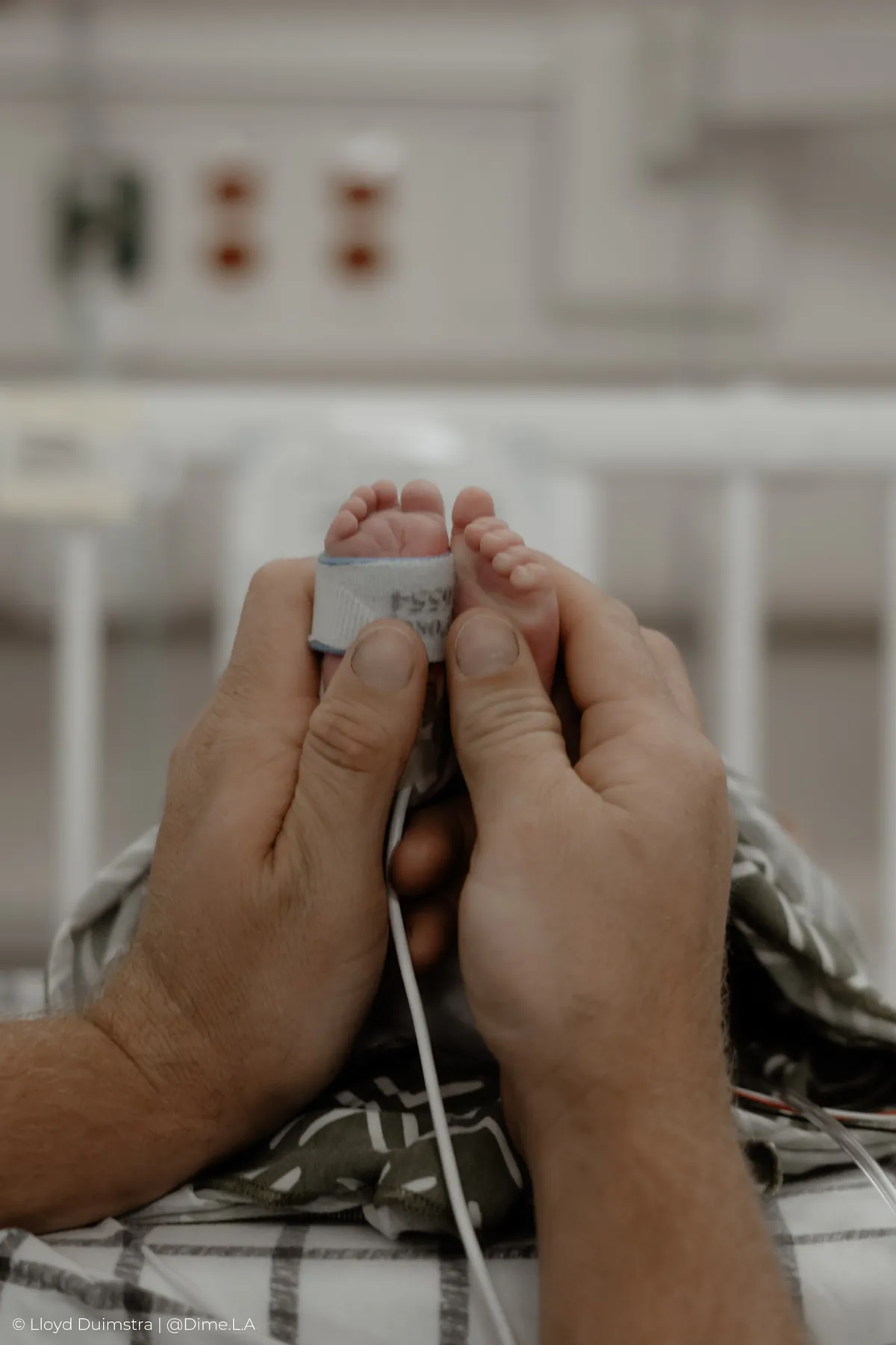 Tiny NICU foot with its monitor band cupped in hands