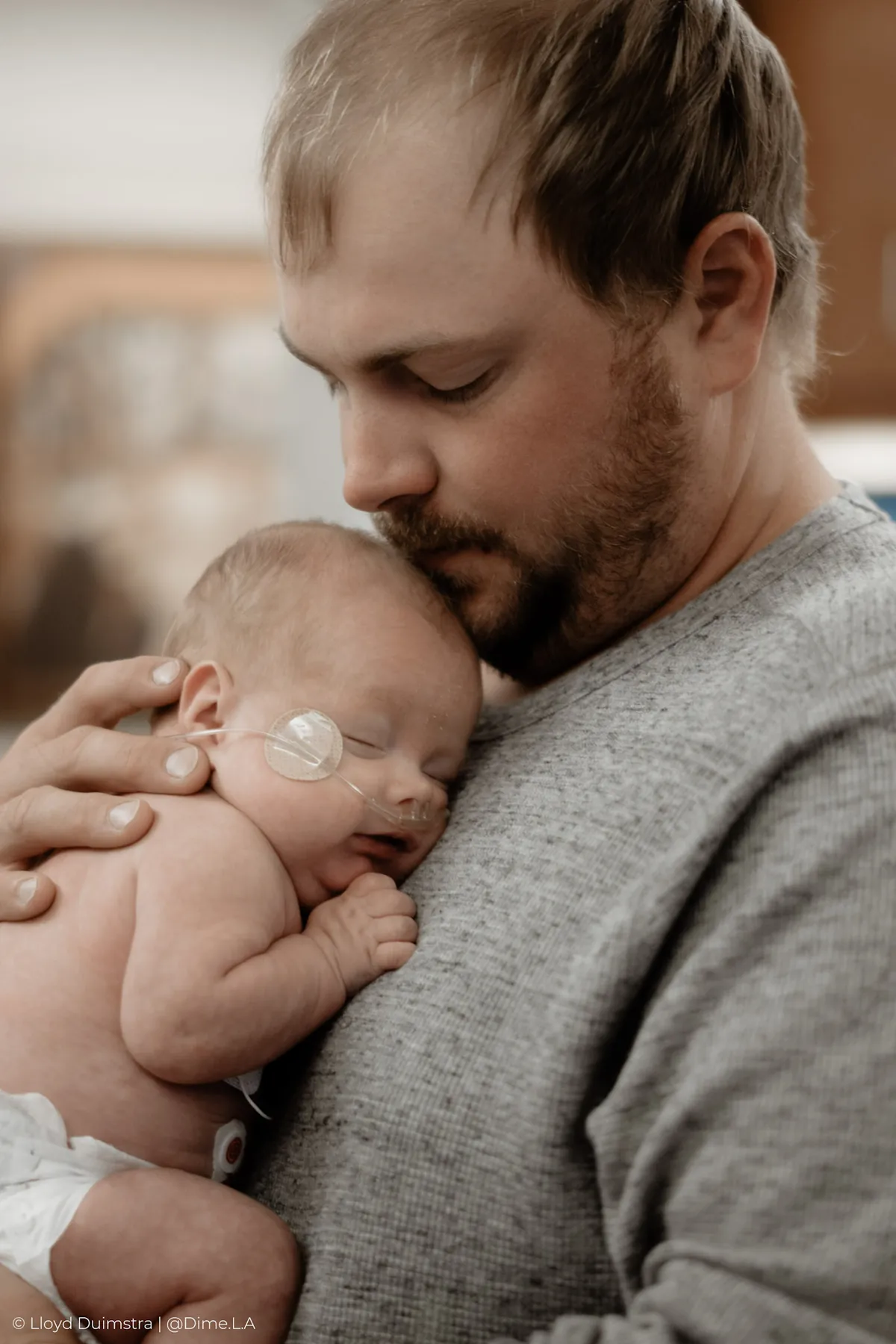 Newborn resting on his dad’s shoulder in the NICU
